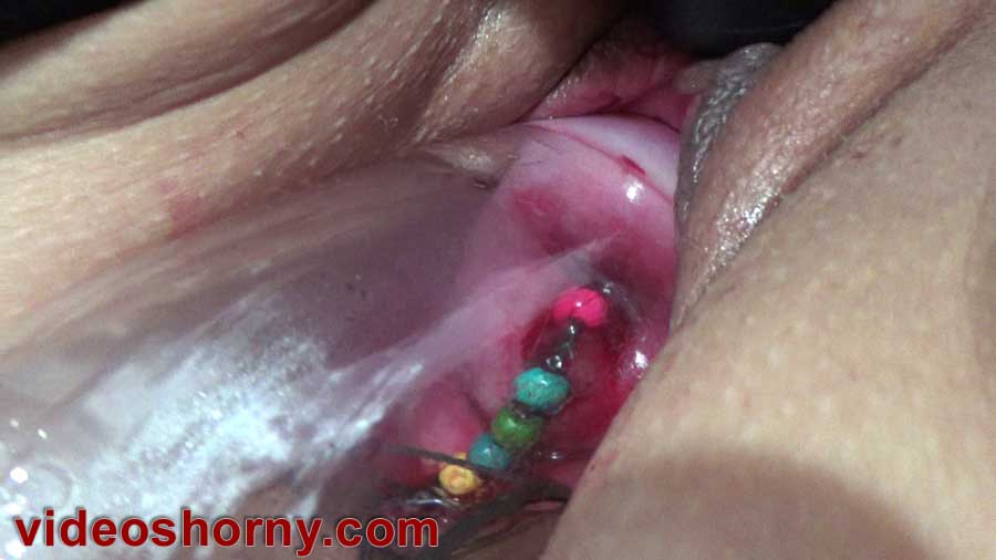 Cervix insertion