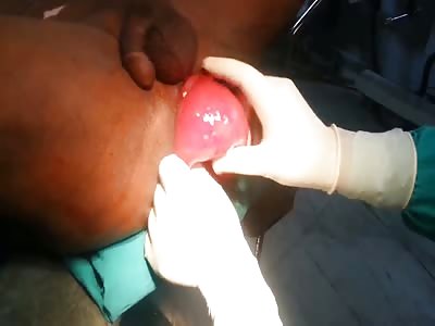 best of Balloon anal water